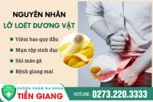 bao-quy-dau-lo-loet--dau-hieu-canh-bao-benh-nguy-hiem-887