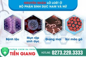 lo-loet-vung-kin-dau-hieu-canh-bao-nhieu-benh-nguy-hiem-1022