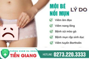 mun-moc-o-moi-be-co-the-tu-khoi-khong-1092