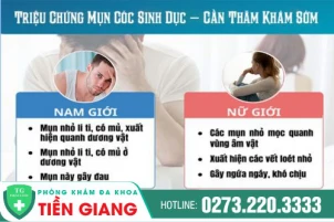 dau-hieu-nhan-biet-mun-coc-sinh-duc-cach-tri-mun-coc-sinh-duc-hieu-qua-1111