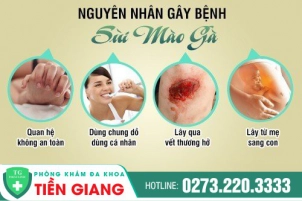 tai-sao-lai-bi-sui-mao-ga-cach-dieu-tri-sui-mao-ga-hieu-qua-1083