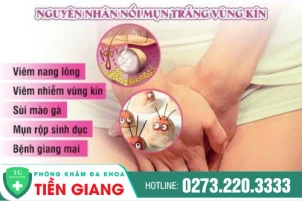 khi-noi-mun-nhot-o-vung-kin-co-nguy-hiem-khong-cach-chua-mun-nhot-953