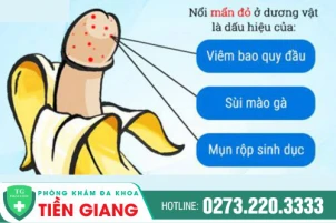 duong-vat-bi-dau-ngua-va-noi-man-do-la-do-dau-966