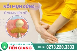 tri-vung-kin-noi-mun-cung-tien-giang-vung-kin-noi-mun-cung-canh-bao-benh-gi-1386