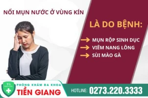 vi-sao-lai-noi-mun-nuoc-o-am-dao-va-cach-chua-benh-1094