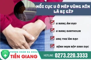 chua-noi-cuc-u-o-mep-vung-kin-tien-giang-noi-cuc-u-o-mep-vung-kin-nguy-hiem-khong-1385