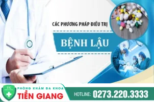 phuong-phap-chua-tri-benh-lau-bang-thuoc-1138