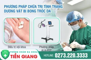 duong-vat-bi-troc-da-nguyen-nhan-do-dau-va-co-nguy-hiem-khong-920