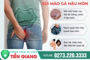 sui-mao-ga-ben-trong-hau-mon-la-gi-cach-dieu-tri-ra-sao-1079