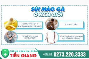 sui-mao-ga-o-bao-quy-dau-trieu-chung-va-cach-dieu-tri-1068
