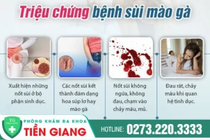 hien-tuong-dien-hinh-cua-benh-sui-mao-ga-cach-dieu-tri-1122