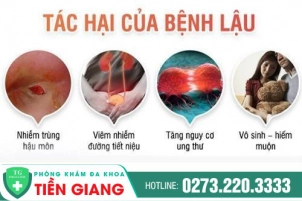 benh-lau-co-nguy-hiem-khong-cach-dieu-tri-hieu-qua-1098