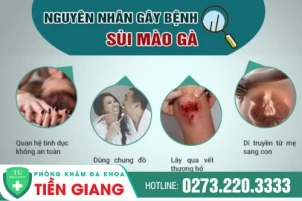 nguyen-nhan-sui-mao-ga-la-gi-cach-chua-sui-mao-ga-hieu-qua-1432