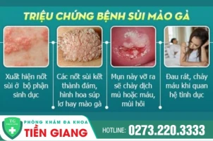 dau-hieu-benh-sui-mao-ga-la-gi-tri-sui-mao-ga-o-dau-hieu-qua-1433