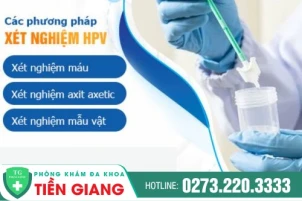 sui-mao-ga-co-nguy-hiem-khong-xet-nghiem-sui-mao-ga-o-dau-uy-tin-1438