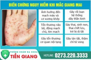 bi-giang-mai-co-nguy-hiem-khong-dieu-tri-cach-nao-hieu-qua-1439