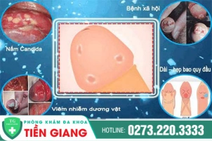 duong-vat-bi-dau-la-benh-gi-nguyen-nhan-va-cach-dieu-tri-hieu-qua-1379