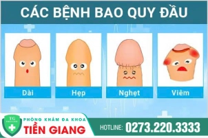 cat-bao-da-quy-dau-va-nhung-thong-tin-can-biet-1381
