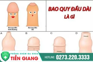 bao-quy-dau-dai-co-sao-khong-dia-diem-cat-bao-quy-dau-uy-tin-1458