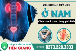 benh-tiet-nieu-co-trieu-chung-gi-phuong-phap-dieu-tri-benh-hieu-qua-1454