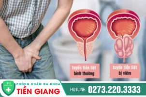 tinh-trang-tieu-rat-kho-tieu-nguy-co-cua-benh-gi-1402
