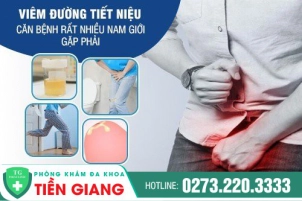 benh-tiet-nieu-o-nam-gioi-va-cach-nhan-biet-chinh-xac-725