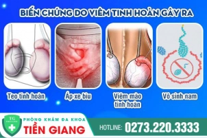 viem-tinh-hoan-la-gi-cach-dieu-tri-viem-tinh-hoan-hieu-qua-876