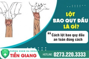 co-nen-tu-lot-bao-quy-dau-tai-nha-dia-chi-lot-bao-quy-dau-an-toan-hien-nay-845