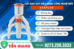 chua-lot-bao-quy-dau-co-anh-huong-gi-khong-cach-lot-bao-quy-dau-bang-cong-nghe-xam-lan-toi-thieu-1460