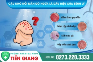 cau-nho-bi-noi-man-do-ngua-co-nguy-hiem-khong-dieu-tri-nhu-the-nao-cho-hieu-qua-896