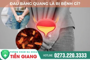 dau-bang-quang-la-bi-benh-gi-cach-chua-dau-bang-quang-hieu-qua-1433