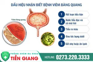 cac-dau-hieu-nhan-biet-viem-bang-quang-o-nam-gioi-778