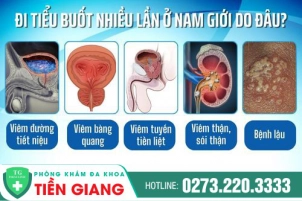 di-tieu-buot-nhieu-lan-la-benh-gi-cach-dieu-tri-hieu-qua-1221