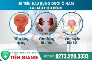 dau-hieu-di-tieu-dau-bung-duoi-bao-hieu-benh-nguy-hiem-nam-gioi-613