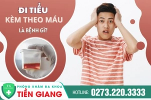 di-tieu-kem-theo-mau-la-nguyen-nhan-benh-gi-co-nguy-hiem-khong-1292