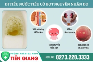 nguyen-nhan-di-tieu-nuoc-tieu-co-nhieu-bot-cach-chua-tri-hieu-qua-1237