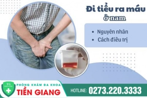 cach-chua-di-dai-ra-mau-hieu-qua-o-nam-gioi-1290