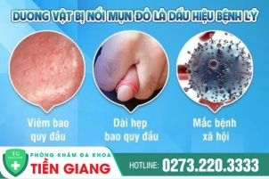duong-vat-noi-mun-do-bat-thuong-vi-sao-730