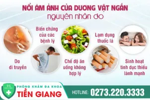 noi-khac-phuc-tinh-trang-duong-vat-ngan-va-chi-phi-khac-phuc-818