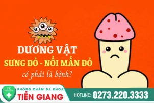 duong-vat-sung-do-noi-man-do-co-phai-la-benh-724