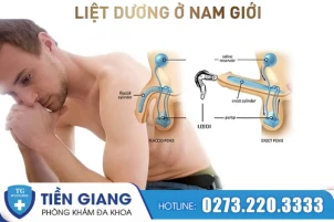 cau-nho-khong-nghe-loi-can-than-voi-benh-liet-duong-1485