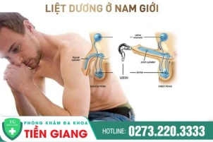 kho-cuong-nhanh-xiu-co-the-ban-dang-doi-mat-voi-tinh-trang-liet-duong-1484