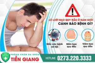 lo-loet-bao-quy-dau-o-nam-gioi-tac-hai-va-cach-dieu-tri-hieu-qua-859