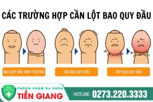 khi-nao-can-lot-bao-quy-dau-dia-chi-lot-bao-quy-dau-an-toan-khong-dau-1467