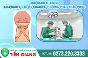 tinh-nghiem-trong-cua-nghet-bao-quy-dau-va-phuong-phap-khac-phuc-nhanh-788