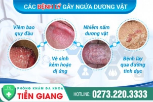 ngua-duong-vat-o-nam-gioi-canh-bao-benh-gi-mach-ban-phuong-phap-dieu-tri-hieu-qua-hien-nay-894