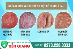 ngua-duong-vat-va-cac-nguyen-nhan-gay-nen-590