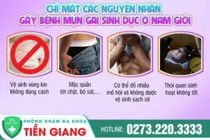 mun-gai-sinh-duc-o-dang-may-rau-co-tu-khoi-phai-chua-tri-nhu-nao-817