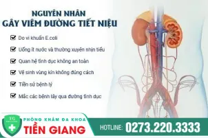 viem-duong-tiet-nieu-nguyen-nhan-trieu-chung-dau-hieu-va-cach-dieu-tri-hieu-qua-1451