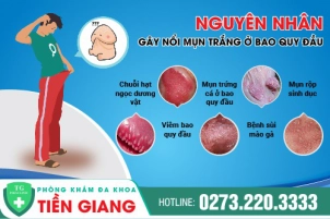 noi-mun-trang-o-bao-quy-dau-co-nguy-hiem-khong-cach-dieu-tri-ra-sao-906